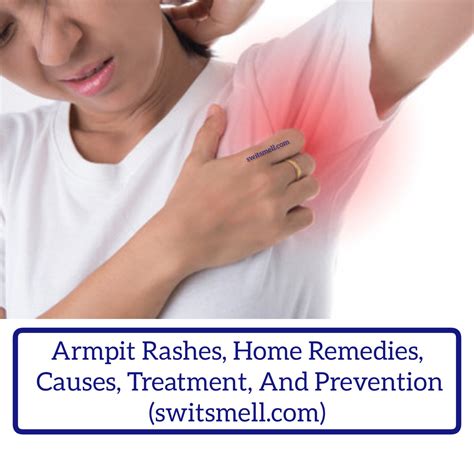 underarm rashes sa kilikili|Armpit rash: Causes, treatment, and prevention .